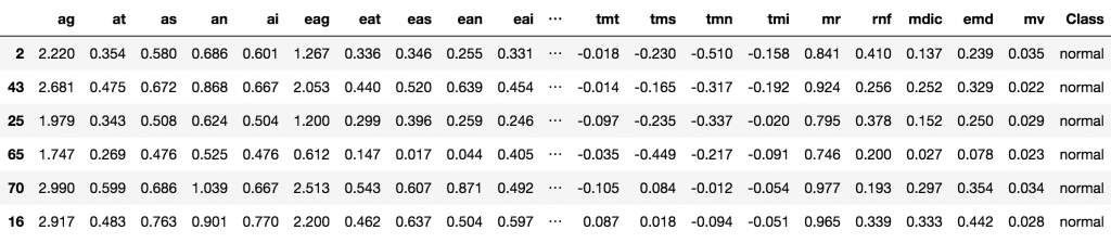 Glaucoma Dataset